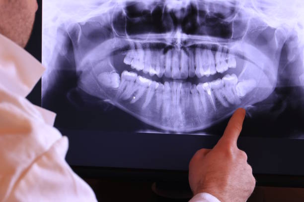 Best Cracked Tooth Emergency Dentist  in Saranap, CA