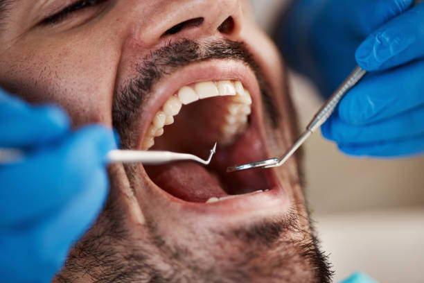 Best Broken Tooth Emergency  in Saranap, CA